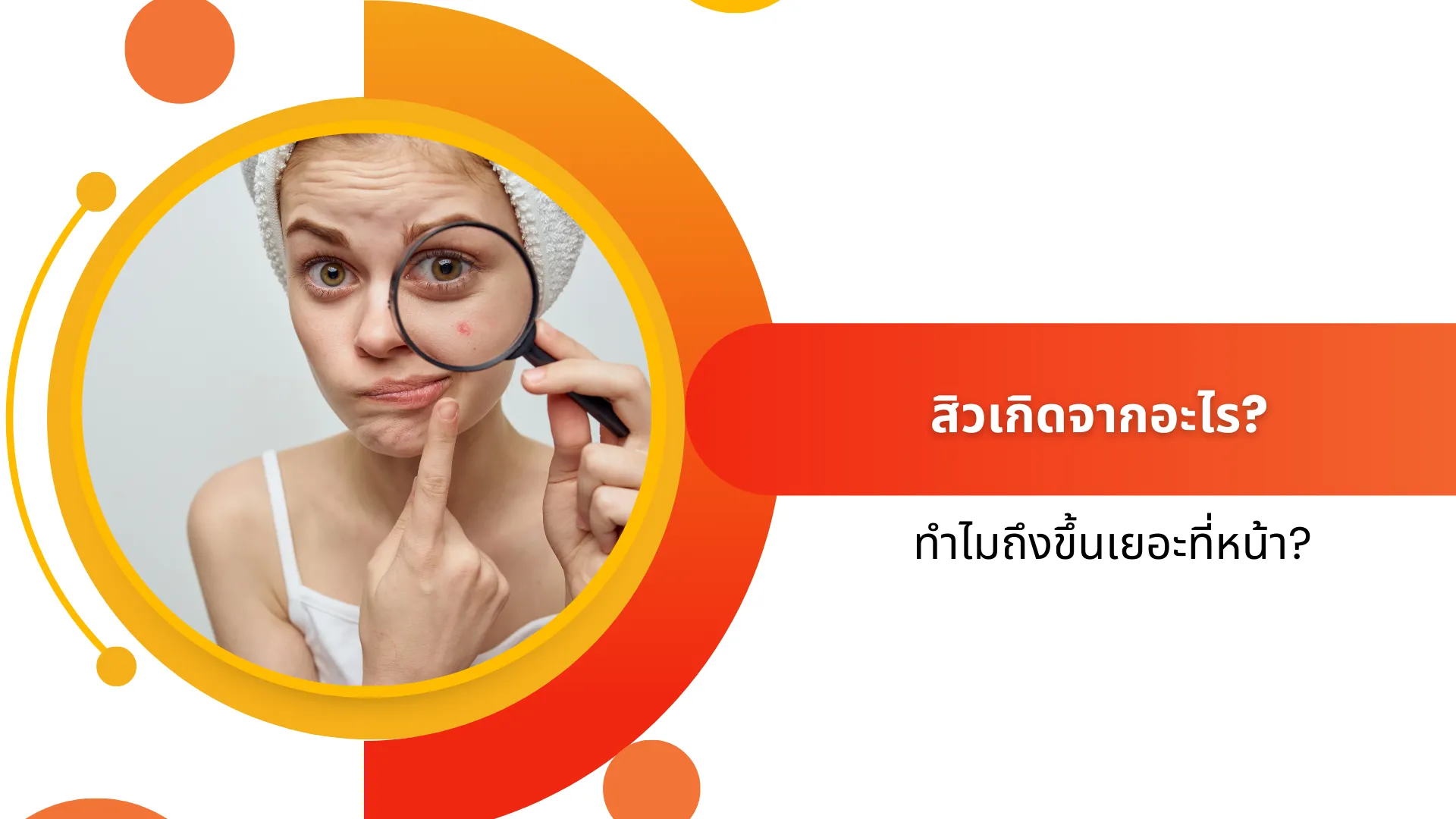 why-acne-appear-so-much-on-the-face
